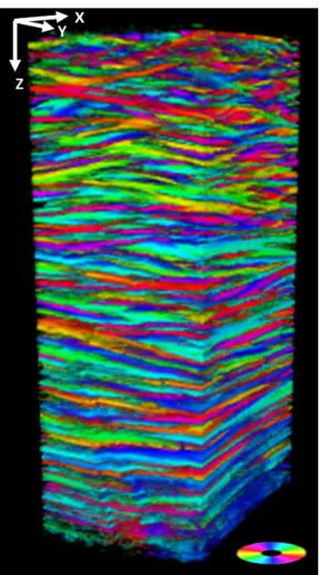 Mapping the structure of human corneas