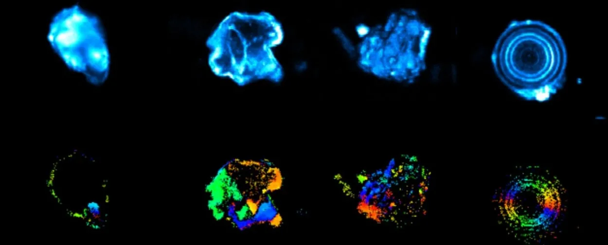 Multiphoton imaging of kidney stones