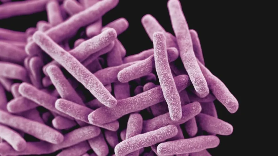 Des défauts dans les gènes de réparation de l’ADN favorisent l’émergence de la résistance aux antimicrobiens chez Mycobacterium tuberculosis