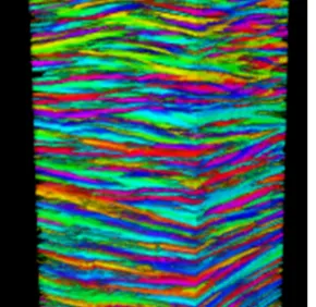 Mapping the structure of human corneas