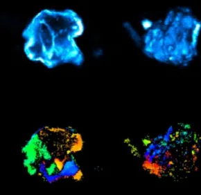 Multiphoton imaging of kidney stones